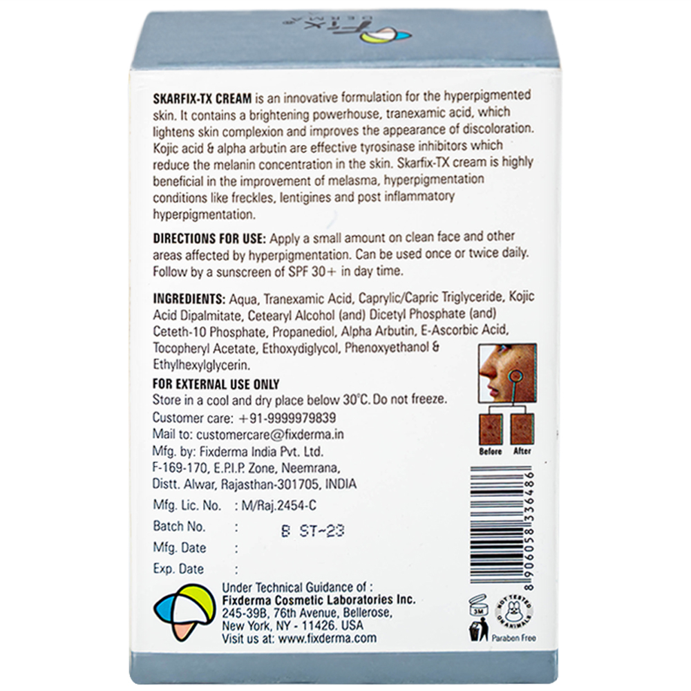Kem bôi giảm nám, tàn nhang, thâm mụn Fixderma Skarfix TX Cream 30g