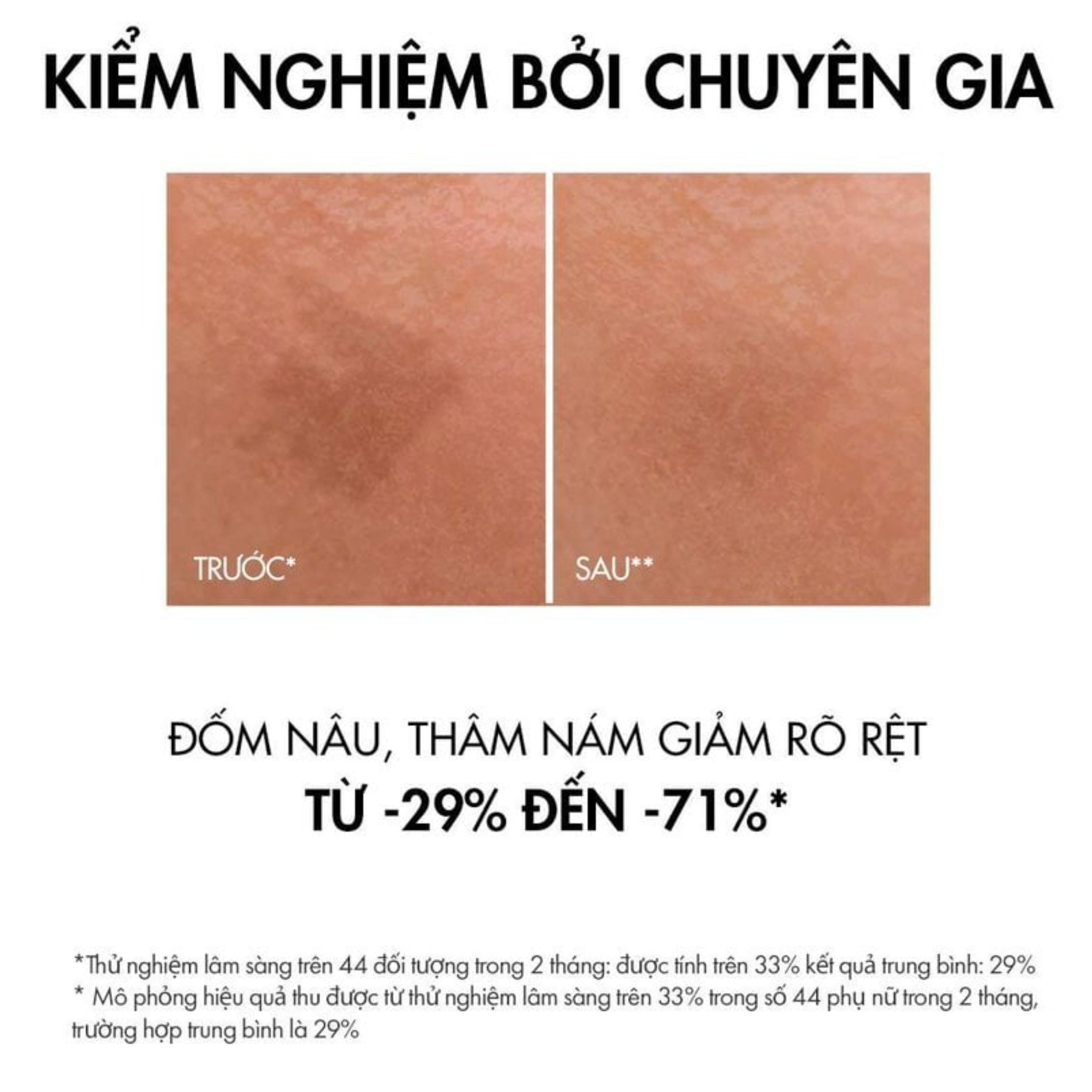 Tinh chất ngăn ngừa thâm nám, đốm nâu Liftactiv Specialist B3 Serum 30ml Vichy
