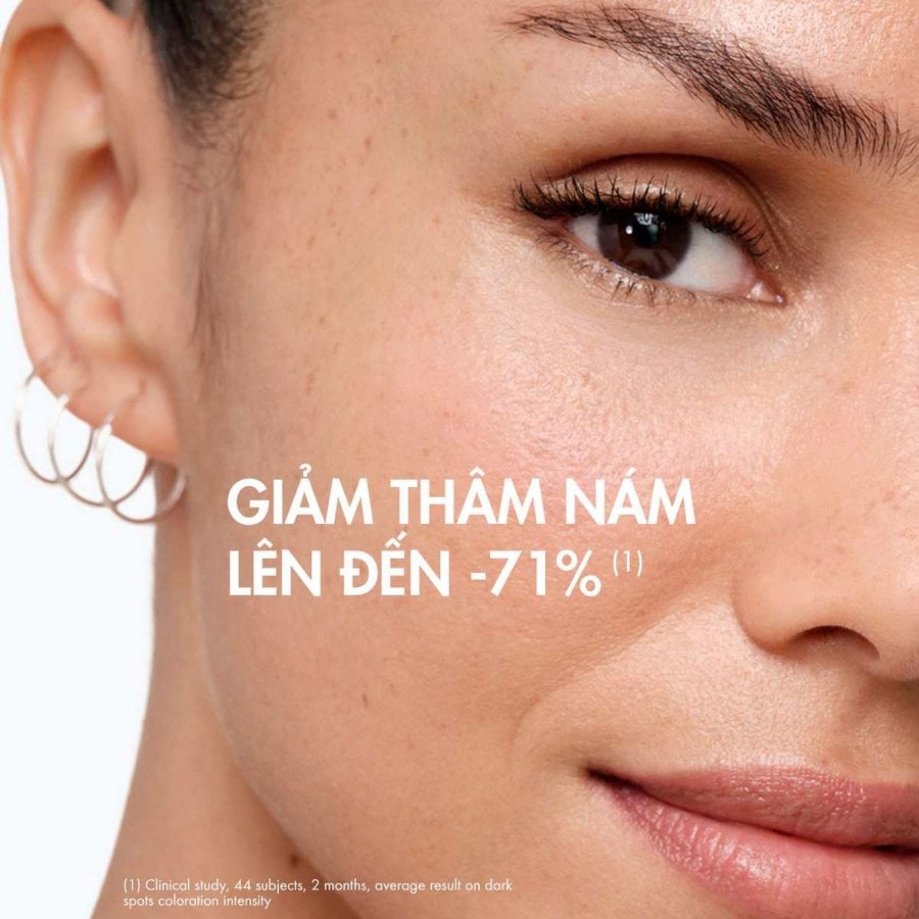 Tinh chất ngăn ngừa thâm nám, đốm nâu Liftactiv Specialist B3 Serum 30ml Vichy