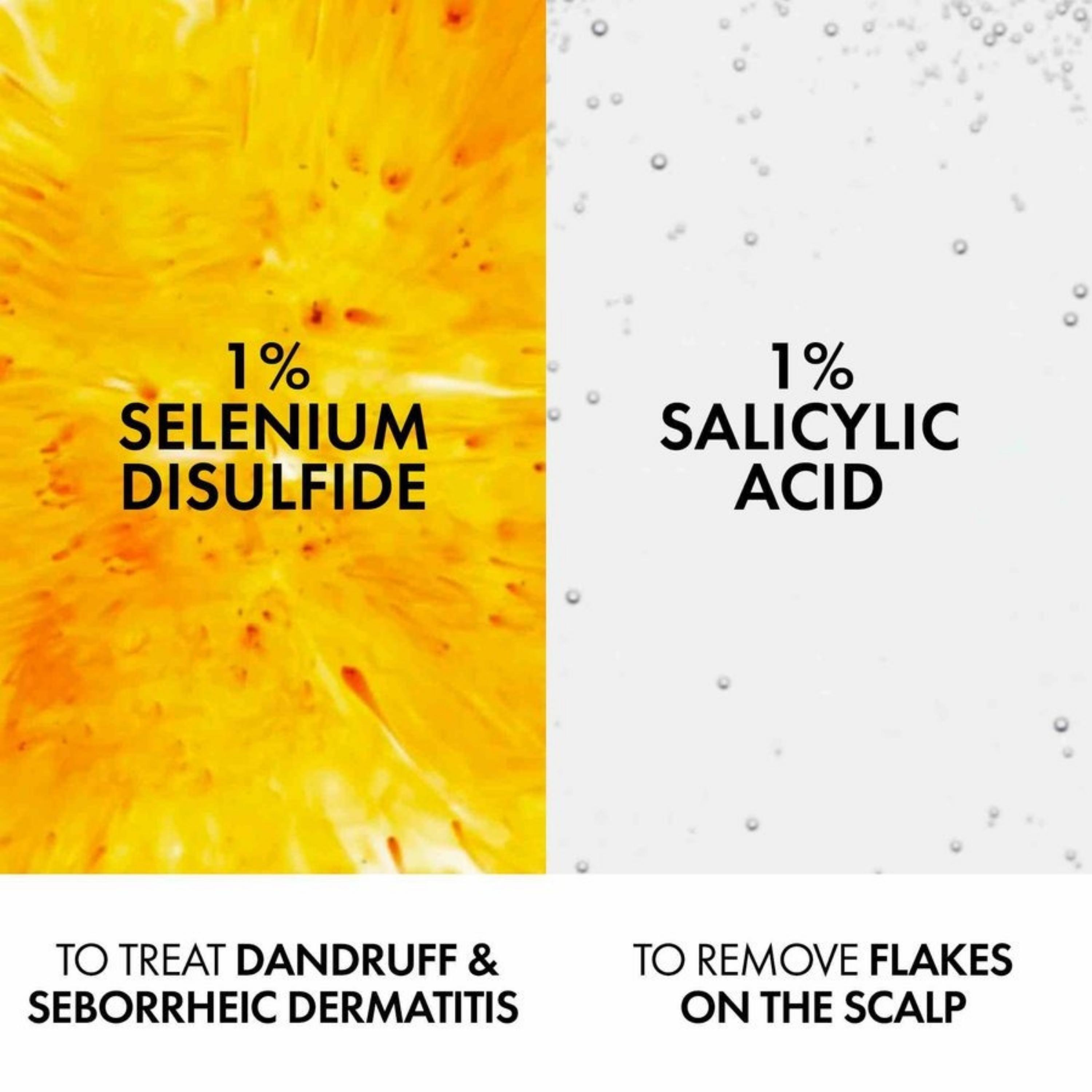 Dầu gội sạch gàu cho da đầu dầu Vichy Dercos Technique Anti Dandruff 200ml