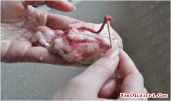 Cách làm óc heo chiên giòn ngon, nhiều dinh dưỡng