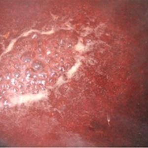 Cách làm salad trái cây đẹp da