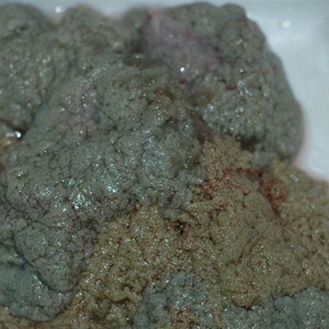 Cách làm trứng gà chiên trứng cá